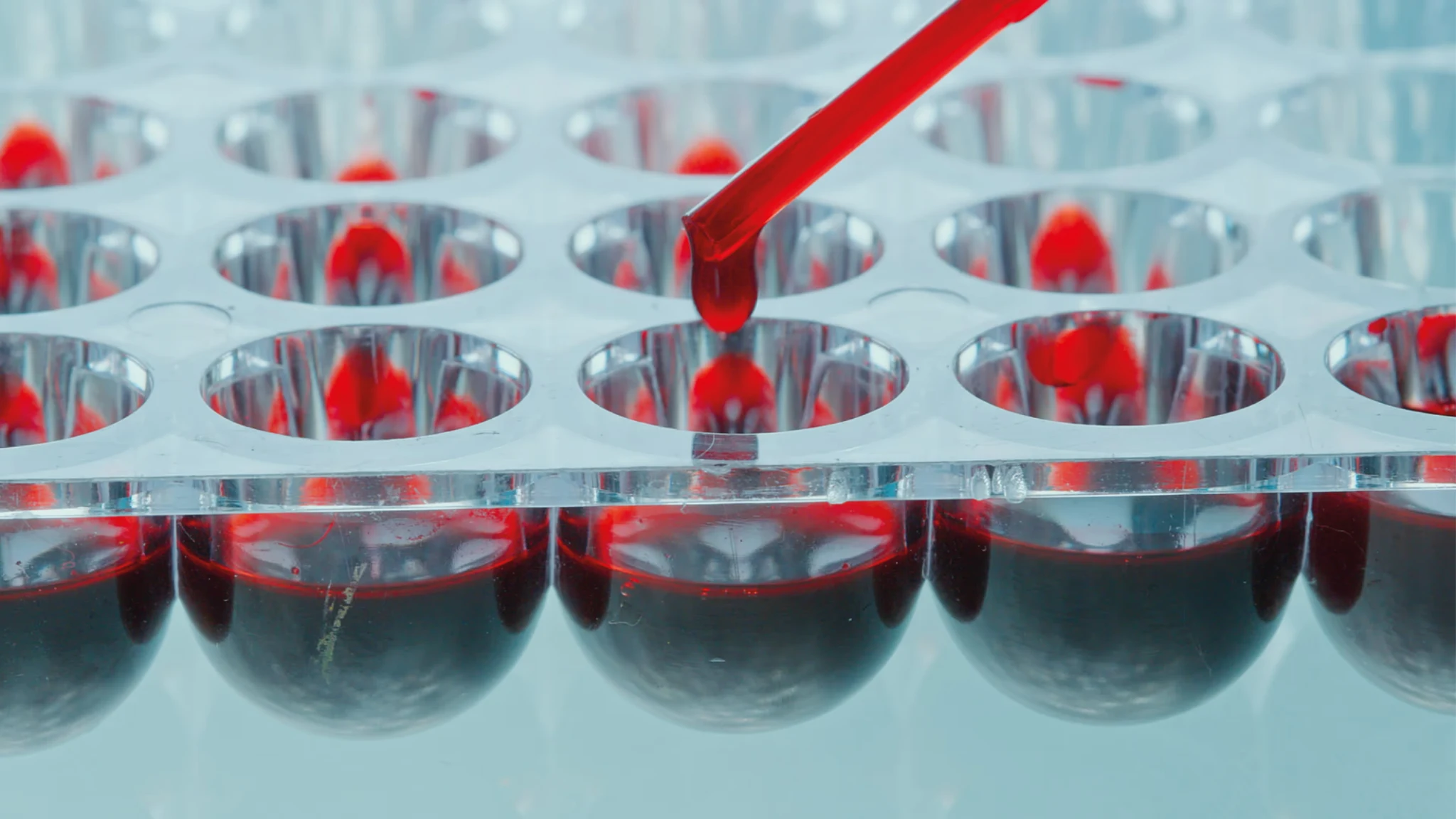 Échantillons biologiques en laboratoire